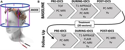 Simultaneous and cumulative effects of tDCS on cerebral metabolic rate of oxygen in multiple sclerosis